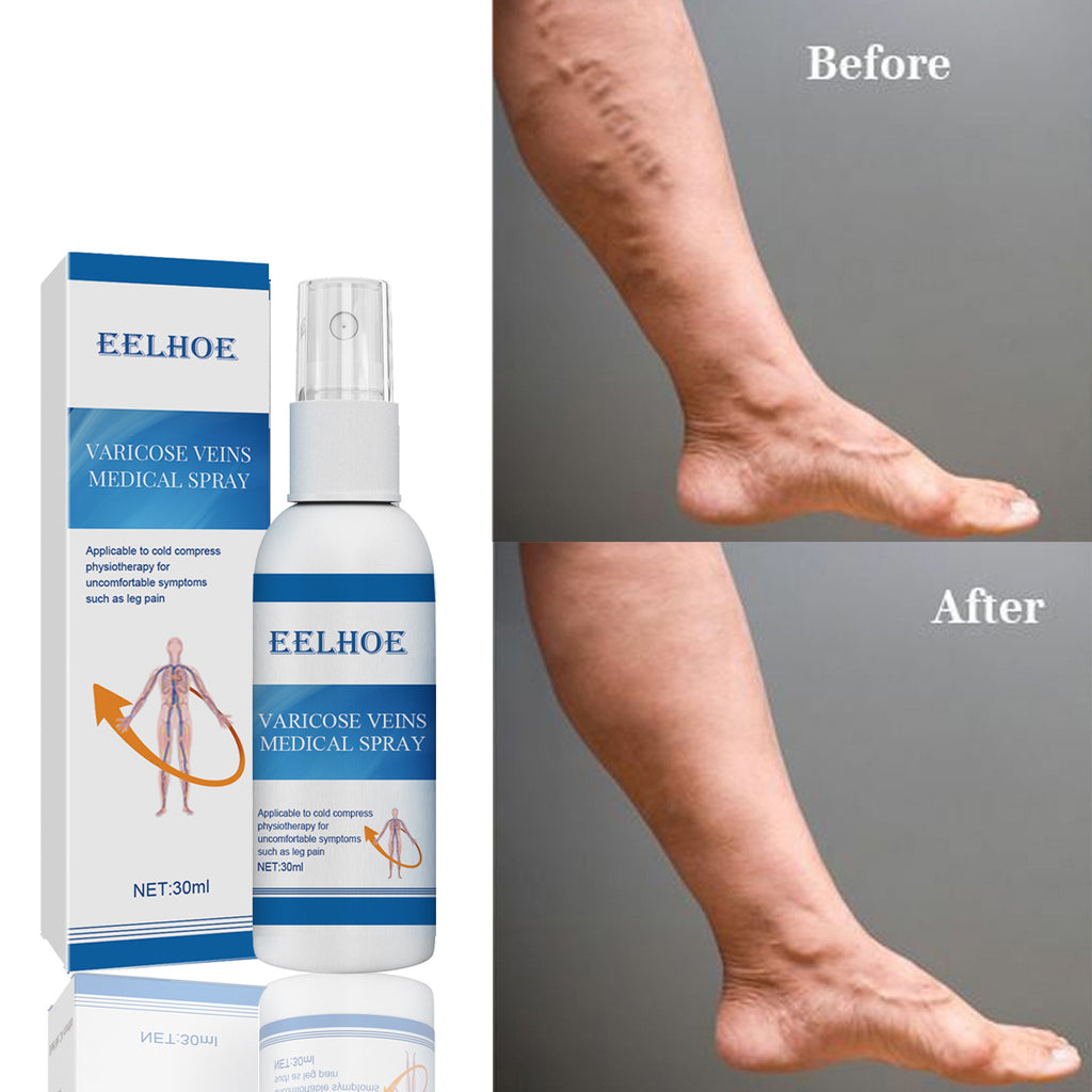 LegEase Vein Relief Spray